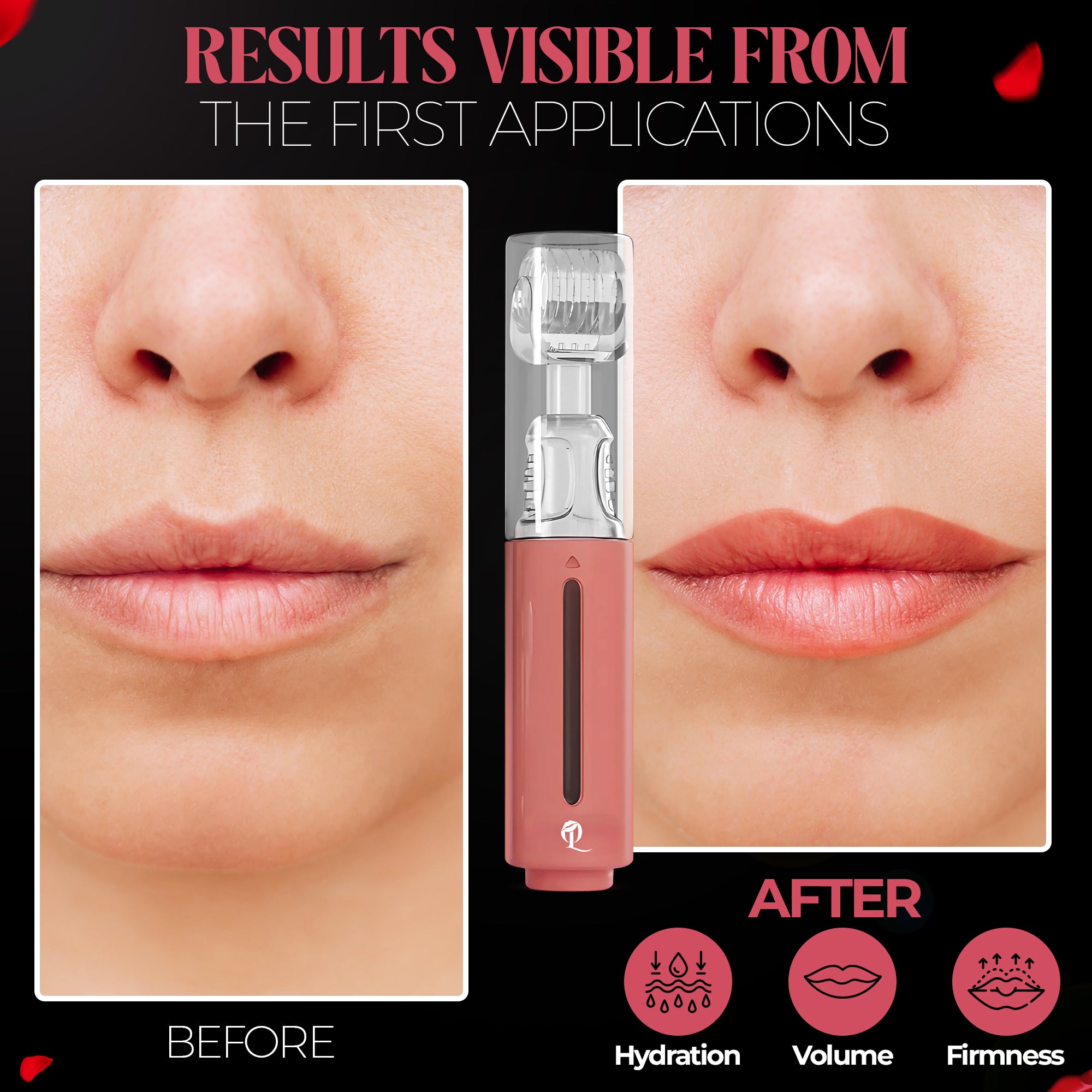 Lips Booster By OPULIPS™